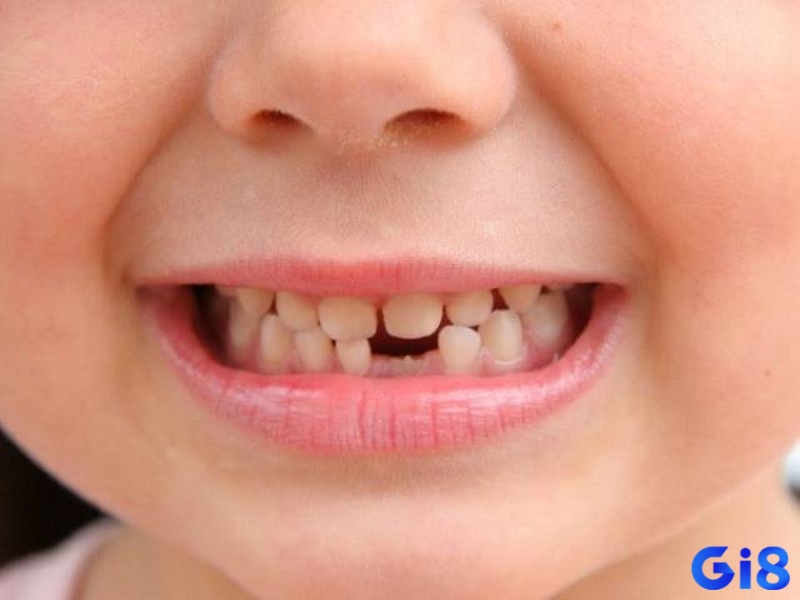 Hình ảnh một chiếc răng gãy, biểu trưng cho những cảm xúc bất an và sự tự ti trong cuộc sống